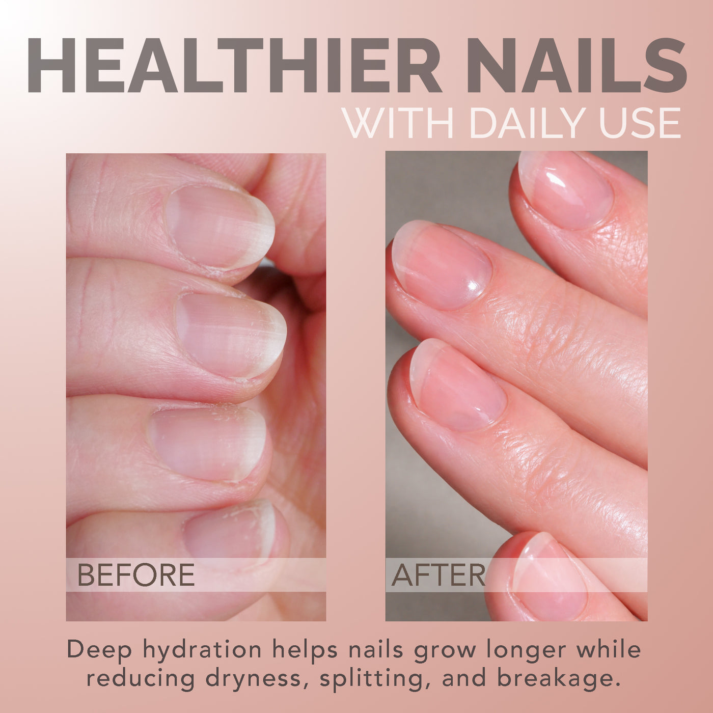 HEALTHIER NAILS WITH DAILY USE / Deep hydration helps nails grow longer while reducing dryness, splitting, and breakage.