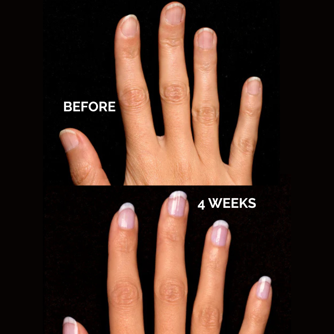 Perfect Formula Delicate Perfect Formula | Best Nail Strengthener Products for Natural Nails ...